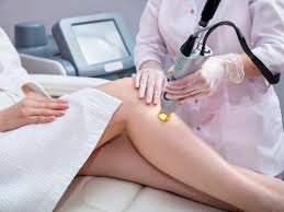 Laser hair removal in Pakistan