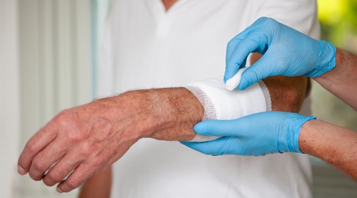 Everything You Need to Know About Wound Dressing at Home Cost