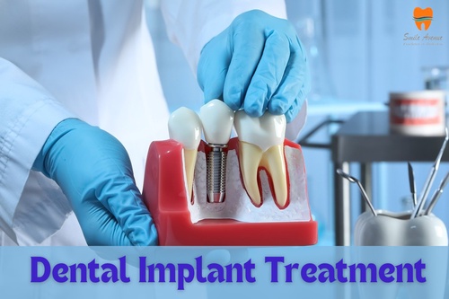 Discovering the Best Dentist in Noida Sector 19 for Dental Implants