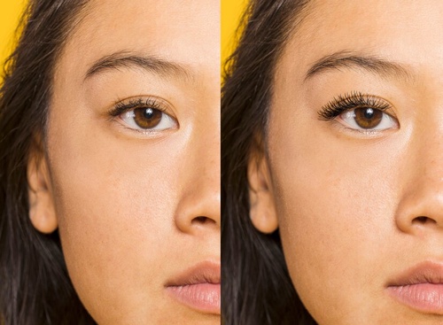 Before and After ~ Real People's Results with Careprost