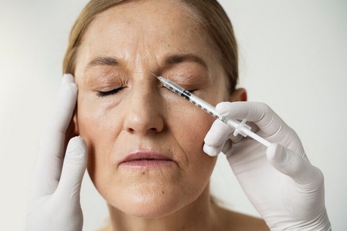 Timeless Radiance: A Guide to Anti-Wrinkle Injections in London