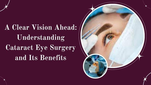 A Clear Vision Ahead: Understanding Cataract Eye Surgery and Its Benefits